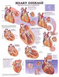 Educate patients and students about heart disease