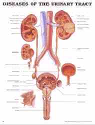 Pictures diseases of the human urinary tract