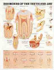 Anatomical Chart - Disorders of Teeth and Jaws